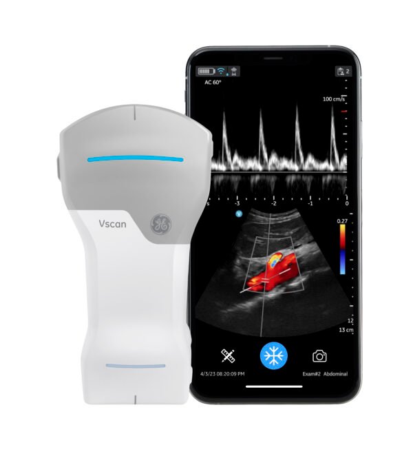 mobiles Farbdoppler Ultraschallgerät Vsacn Air CL mit Handy und Darstellung Aorta mit PW-Mode