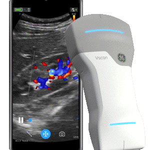 mobiles Farbdoppler Ultraschallgerät Vscan Air CL