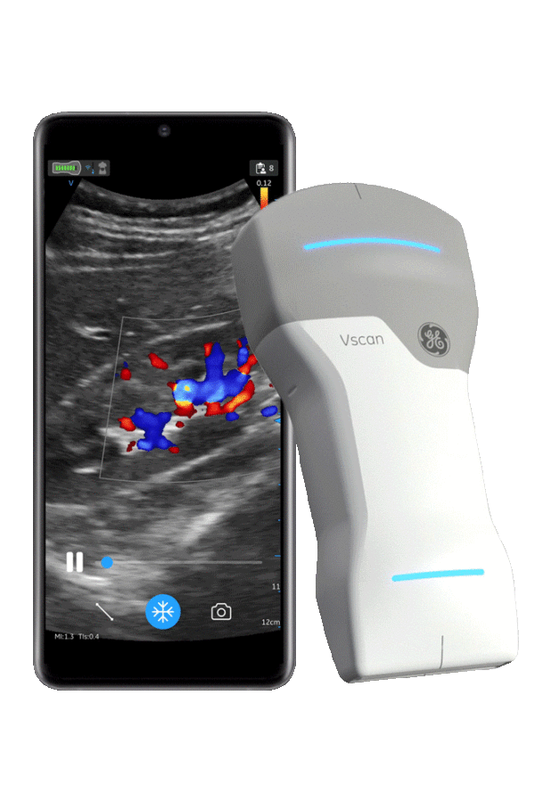 mobiles Farbdoppler Ultraschallgerät Vscan Air CL