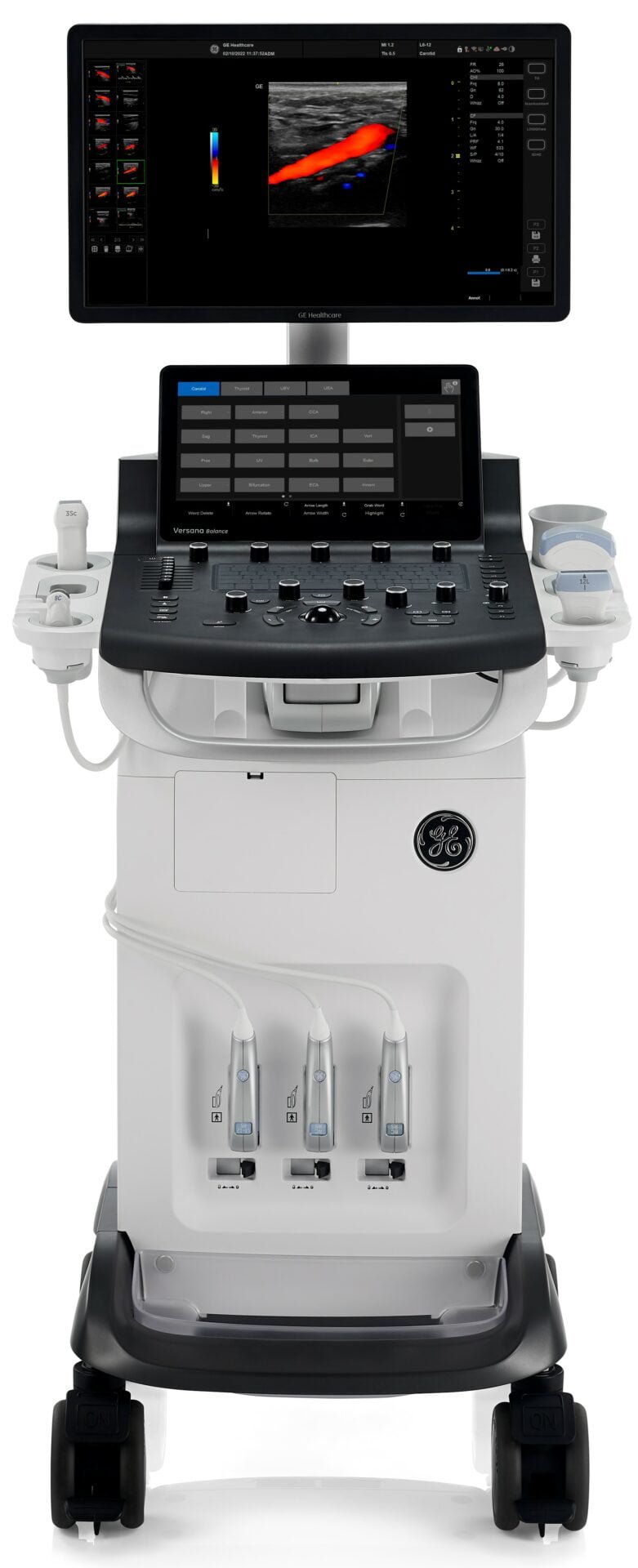 Ultraschallgerät Versana Balance von GE Healthcare