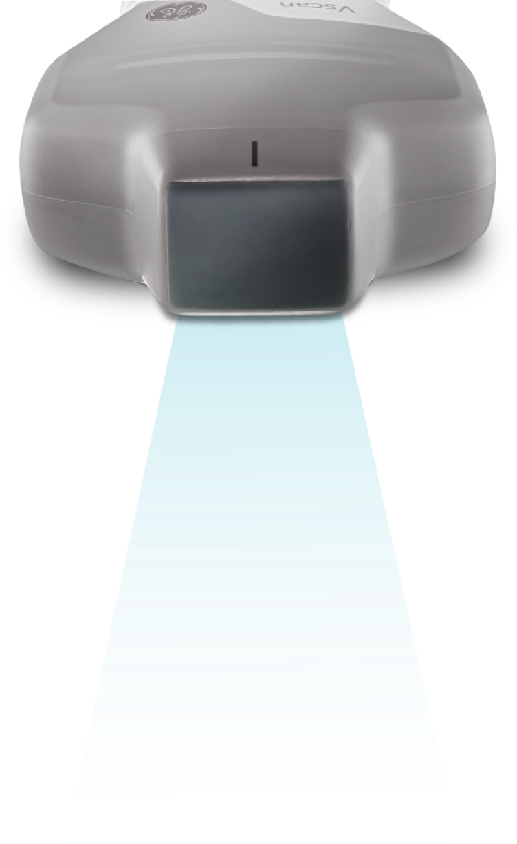 Der Vscan Air CL besitzt eine Linear- und Convexsonde, der Vscan Air SL eine Linear- und Sektorsonde.